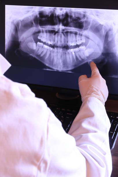 Best Emergency Dentist for Lost Fillings or Crowns in Elsmere, DE